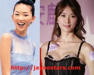 Chiling Lam plastic surgery breast implants