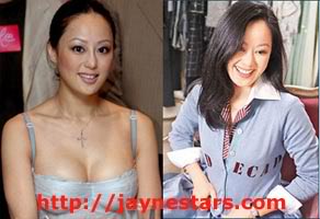 Teresa Zhang plastic surgery breast implants