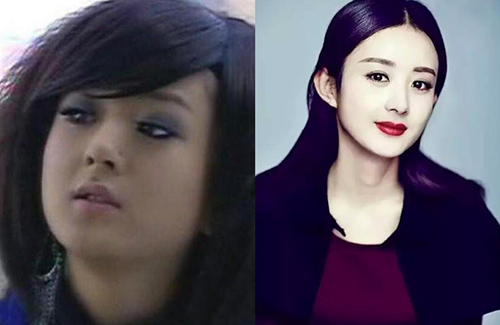 zhao-liying-beforeafter