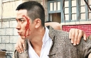 Ron Ng Suffers Bloody Head Blow in “Prominent Family” thumbnail