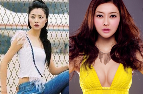 Model Plastic Surgery: Lynn Hung, Gaile Lok, Chrissie Chau, and Janice Man thumbnail