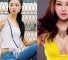Model Plastic Surgery: Lynn Hung, Gaile Lok, Chrissie Chau, and Janice Man thumbnail