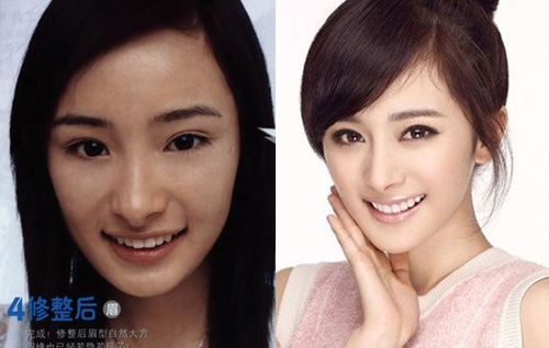 Plastic Surgery: Yang Mi’s Nose And Jaw Refinement thumbnail