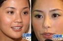 “The Ugly Files”: Actresses’ Bad Skin and Wrinkles Exposed! thumbnail