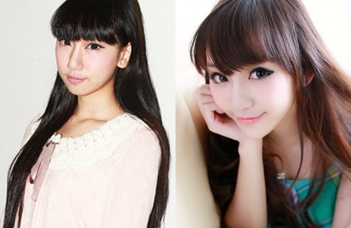 Plastic Surgery: Cammi Tse, Shiga Lin, and Mia thumbnail