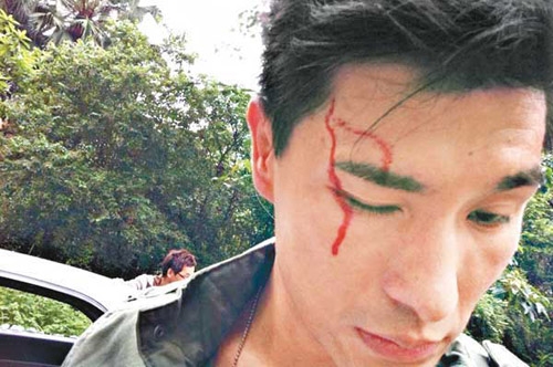 Ruco Chan Injures Eye While Filming “ATF Counter Terrorism Unit” thumbnail