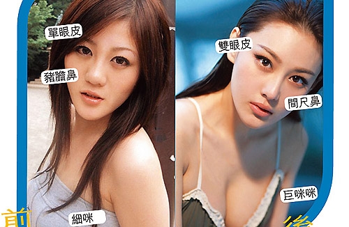 Plastic Surgery: Viann Zhang’s Dramatic Transformation thumbnail