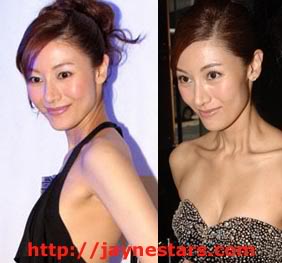 Michelle Reis plastic surgery breast implants