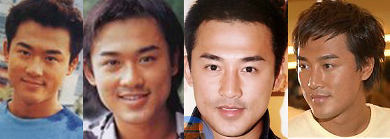 Raymond Lam plastic surgery nose job
