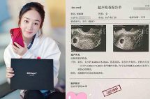 Zanilia Zhao is Pregnant; Baby’s Ultrasound Leaked